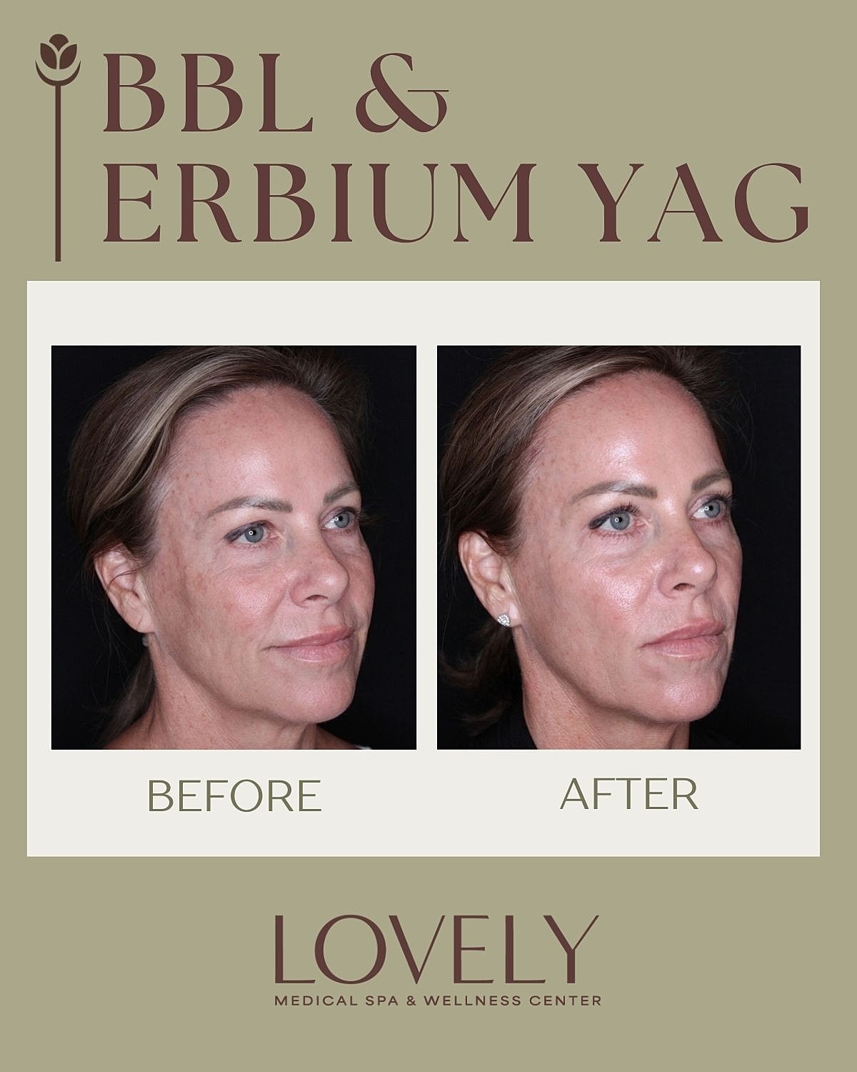 Before and after skin rejuvenation treatment results.
