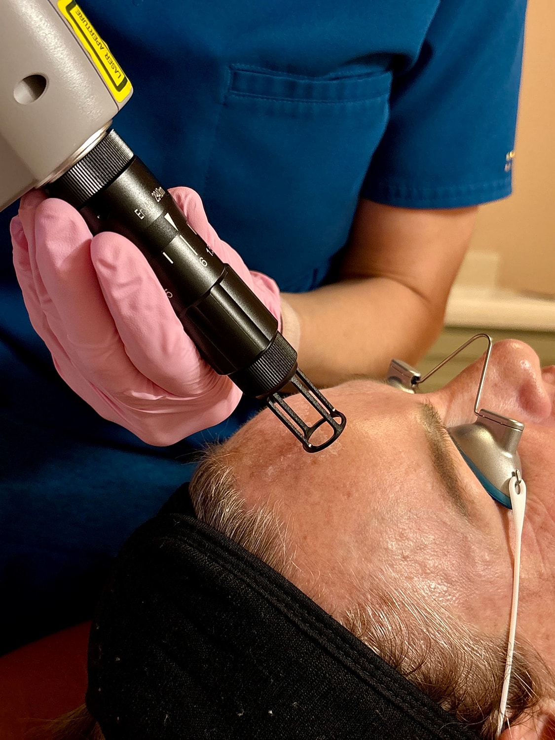 Laser treatment being applied on a patient's forehead.